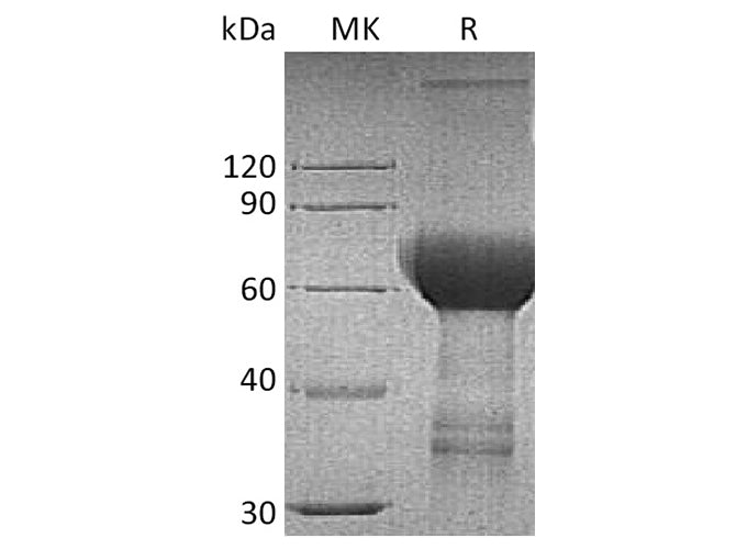 Recombinant Human TROP2/TACSTD2 Protein (Fc Tag)
