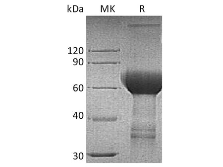 Recombinant Human TROP2/TACSTD2 Protein (Fc Tag)