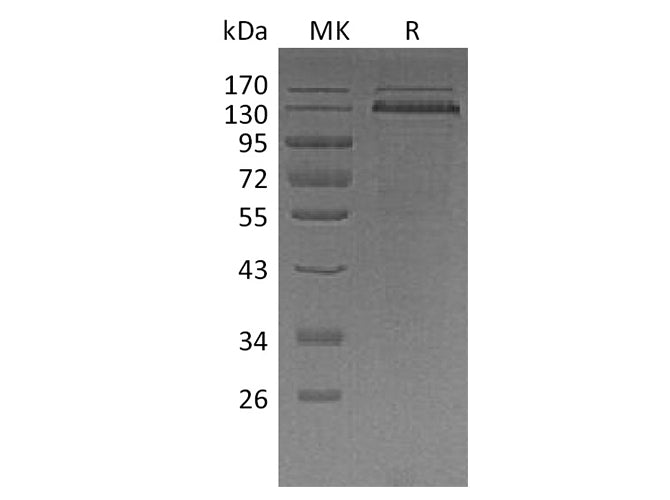 Recombinant Human Thrombospondin-1/THBS1 Protein (His Tag)(Active)