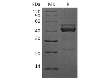 Recombinant Human TIGIT Protein (mFc Tag)