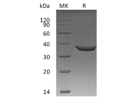 Recombinant Human STING/TMEM173 Protein (Sumo & His Tag)