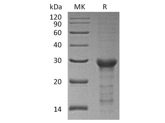 Recombinant Human STAT6 Protein (E.coli, His Tag)