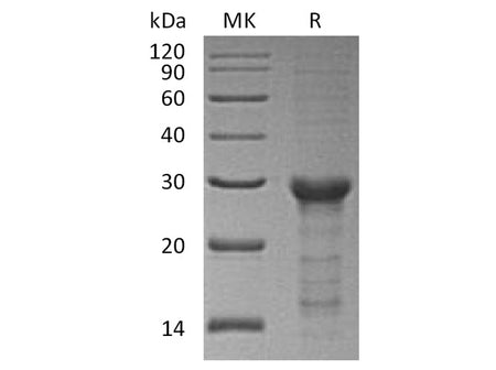Recombinant Human STAT6 Protein (E.coli, His Tag)