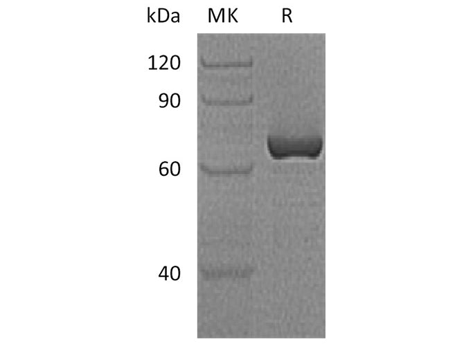 Recombinant Human Vaspin/SerpinA12 Protein (GST Tag)
