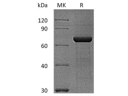 Recombinant Human Semaphorin 3A/SEMA3A Protein (His & Flag Tag)