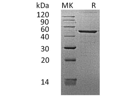 Recombinant Human REG3G/PAP-1B Protein (Fc Tag)