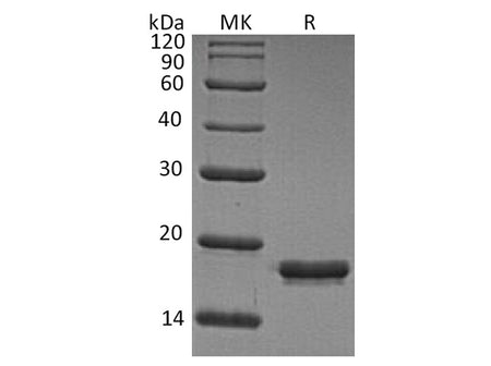 Recombinant Human REG1A/PSPS Protein (His Tag)