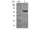 Recombinant Human RHEB Protein (GST Tag)