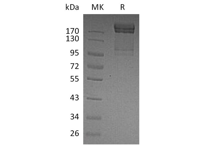 Recombinant Human PSGL-1/CD162 Protein (Fc Tag)