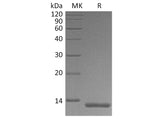 Recombinant Human S100A4 Protein (His Tag)