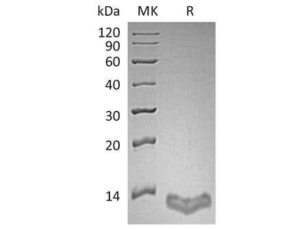Recombinant Human S100A16/S100F Protein