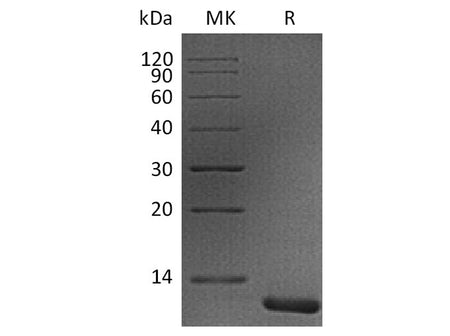 Recombinant Human S100A11 Protein