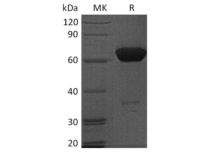 Recombinant Human PD-1/PDCD1 Protein (Fc Tag)(Active)