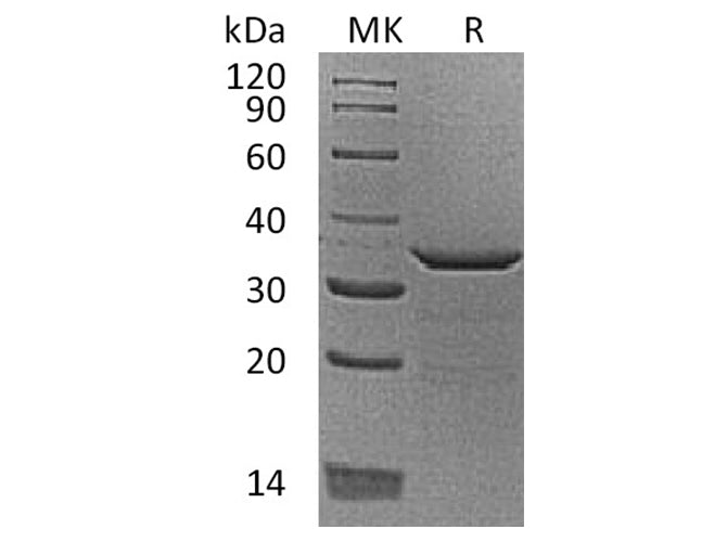 Recombinant Human Proenkephalin-B/PDYN Protein (His Tag)