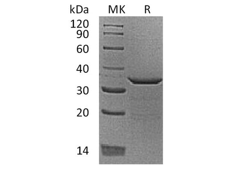 Recombinant Human Proenkephalin-B/PDYN Protein (His Tag)