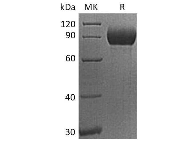 Recombinant Human CD155/PVR/NECL5 Protein (Fc Tag)