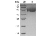 Recombinant Human CD155/PVR/NECL5 Protein (His Tag)(Active)