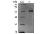 Recombinant Human Noggin/NOG Protein (aa 28-232, Fc Tag)(Active)