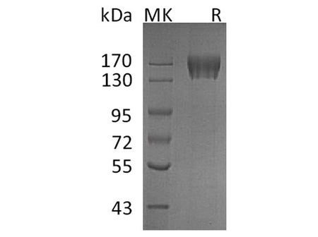 Recombinant Human c-KIT/CD117 Protein (His Tag)