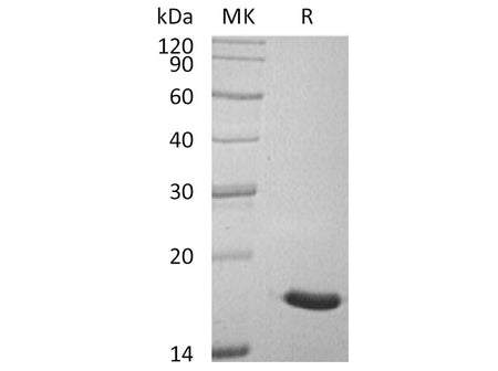Recombinant Human ACP1/LMW-PTP Protein (His Tag)