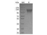 Recombinant Human LEPR/CD295 Protein (His Tag) Purity >95%