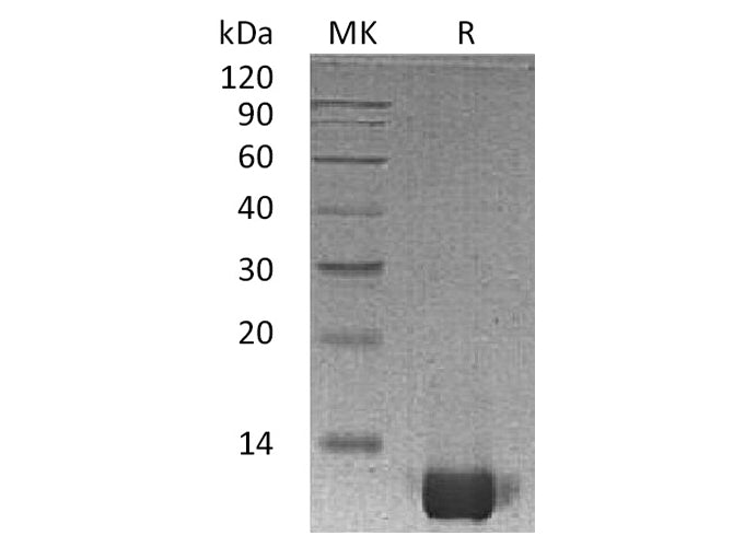 Recombinant Human IL-8/CXCL8 Protein (aa 23-99) 