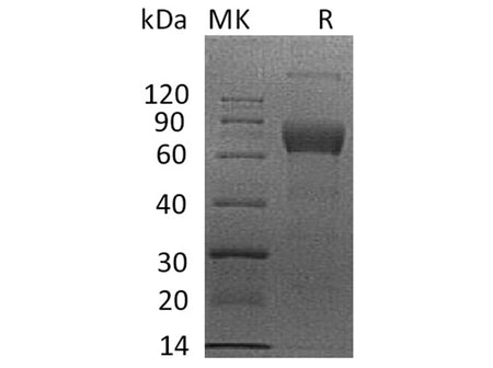 Recombinant Human IL4RA/CD124 Protein (mFc Tag)