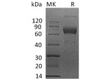 Recombinant Human IL4RA/CD124 Protein (mFc Tag)