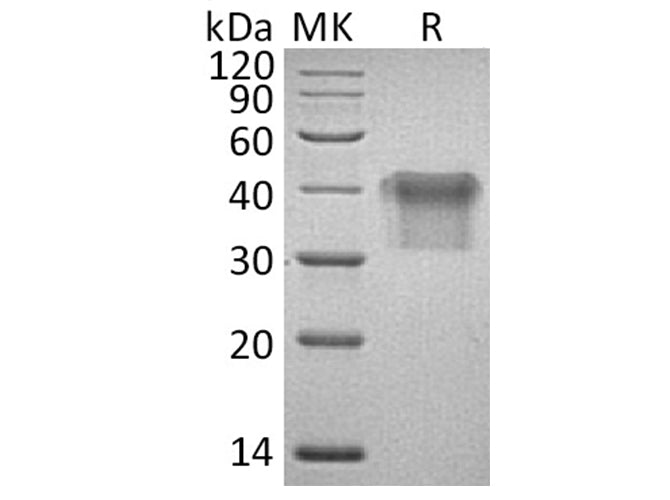 Recombinant Human IL2Ra/CD25 Protein (His Tag)