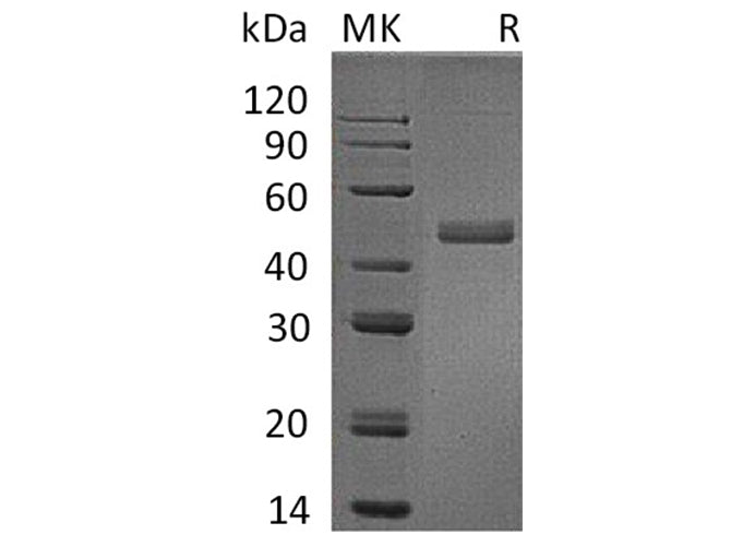 Recombinant Human IL17B/IL-17B Protein (Fc Tag)