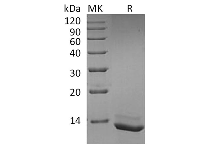 Recombinant Human Interleukin-15/IL-15 Protein (Active)