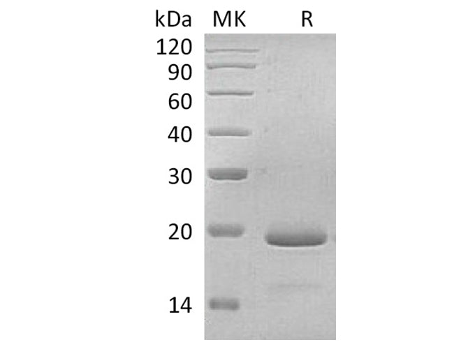Recombinant Human Interleukin-11/IL-11 Protein