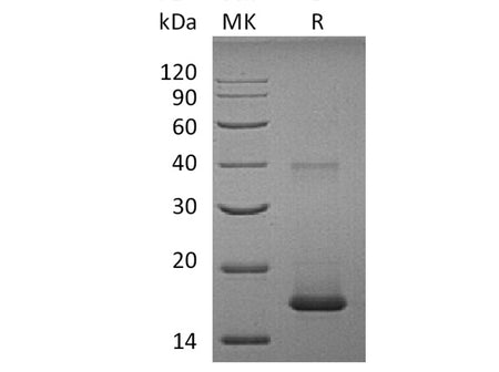 Recombinant Human IL1F10/IL-38 Protein