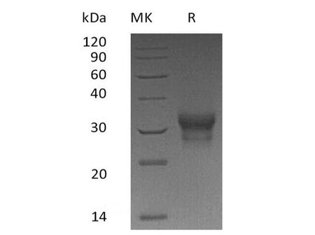 Recombinant Human IFN-λ1/IL-29 Protein (His Tag)