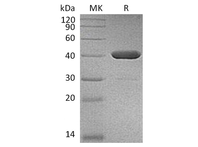 Recombinant Human IDO2 Protein (His Tag)