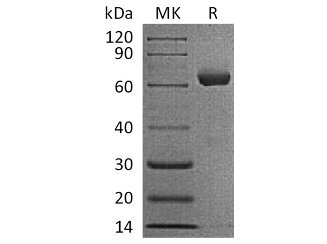 Recombinant Human IGSF11/BTIGSF Protein (Fc Tag)