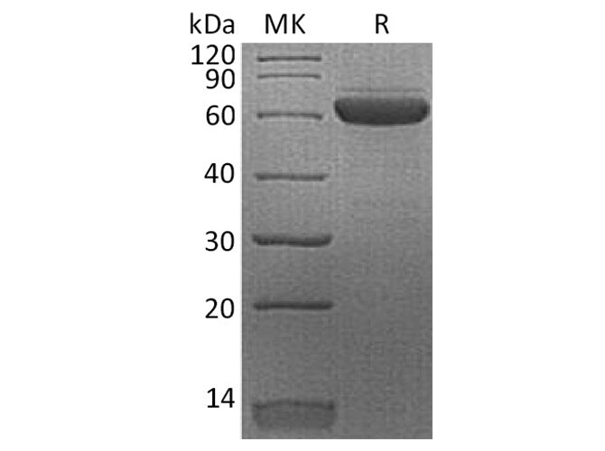 Recombinant Human Erythropoietin R/EPOR Protein (Fc Tag)