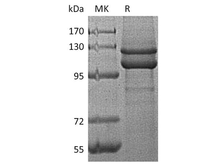 Recombinant Human E-Cadherin/CDH1 Protein (His Tag) Purity >95%