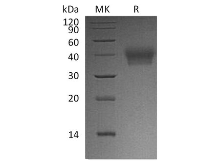 Recombinant Human BTN2A1 Protein (His Tag)