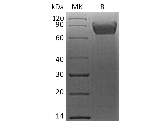 Recombinant Human B7-H4/VTCN1 Protein (mFc Tag)
