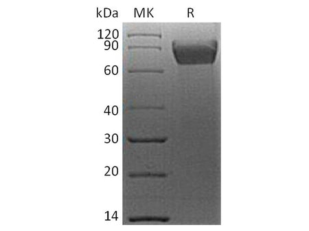 Recombinant Human B7-H4/VTCN1 Protein (mFc Tag)