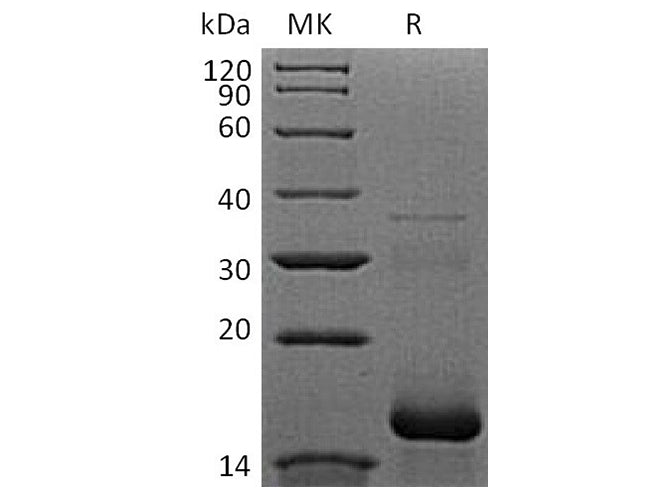 Recombinant Human APOB/Apolipoprotein B-100 Protein (His Tag)