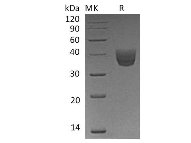 Recombinant Human CD157/BST1 Protein (His Tag)