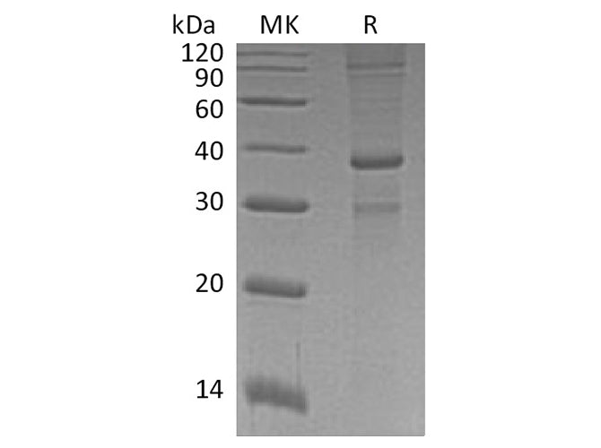 Recombinant Human ASXL1 Protein (GST Tag)
