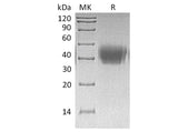 Recombinant Human Activin RIIA/ACVR2A Protein (His Tag)