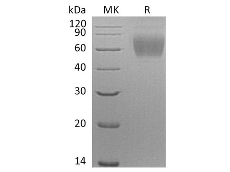 Recombinant Human SIGLEC9/CD329 Protein (His Tag)(Active)