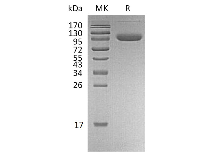 Recombinant Human PD-L1/B7-H1/CD274 Protein (Fc & Avi Tag)
