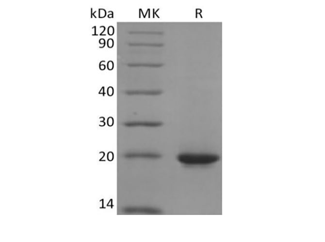 Recombinant Human Sonic Hedgehog/SHH (C-6His)