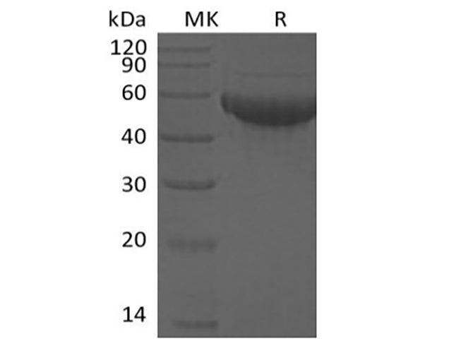 Recombinant Human Siglec-8 (C-6His)