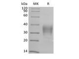 Recombinant Human CD79B/B29 (C-6His-Avi) Biotinylated